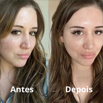 Kit com 5 Mascaras Coreanas - Para um autocuidado Completo